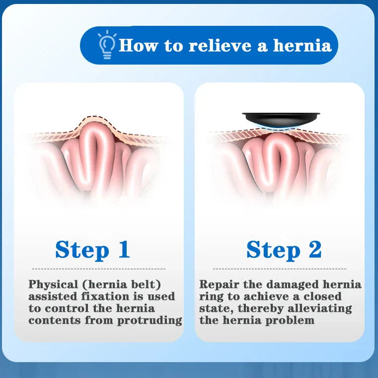 Ceinture Hernie Inguinale