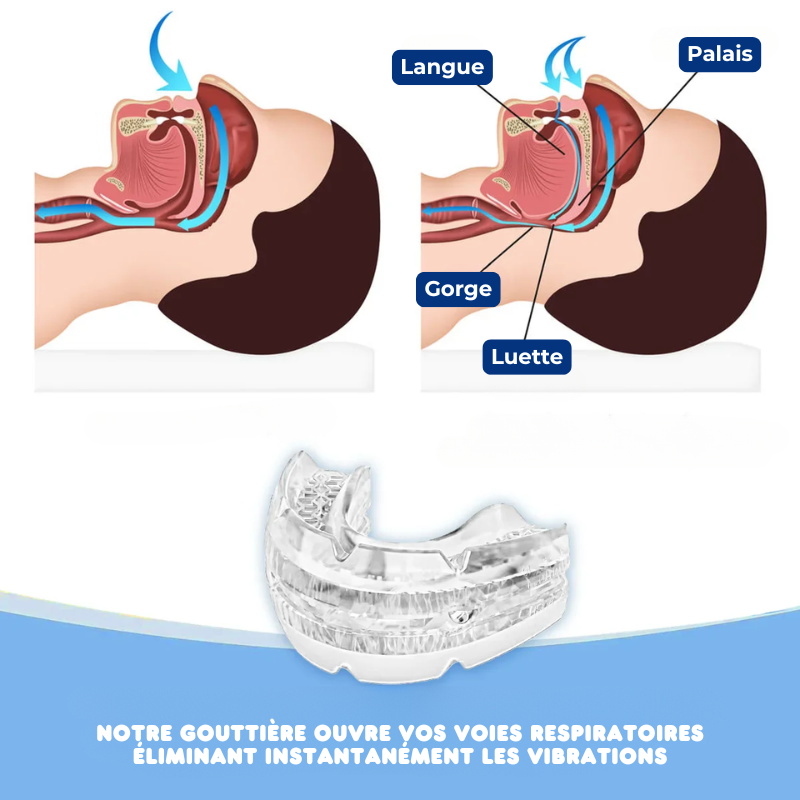 SILENCE SLEEP - Anti-Snoring & Anti-Apnea Mouthpiece
